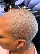 Load image into Gallery viewer, Micro-needle Roller can be used to INCREASE PRODUCTS ABSORPTION, Reduce Fine Lines, Wrinkles, Age Spots and Stretch Marks