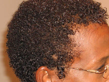 Load image into Gallery viewer, AFTER: Embark on a journey of hair transformation with our Herbal Re-Growth Serum, carefully crafted to harness the revitalizing power of nature. Enriched with a fusion of botanical extracts, including invigorating Moringa, Nettle, Amla, Ginseng, Gingko Biloba, Lavender Essential Oil, and Revitalizing Ginseng. Our serum is a testament to the potency of herbal remedies for hair care.