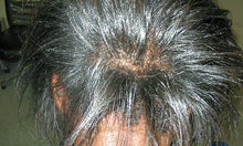 Load image into Gallery viewer, AFTER: Embark on a journey of hair transformation with our Herbal Re-Growth Serum, carefully crafted to harness the revitalizing power of nature. Enriched with a fusion of botanical extracts, including invigorating Moringa, Nettle, Amla, Ginseng, Gingko Biloba, Lavender Essential Oil, and Revitalizing Ginseng. Our serum is a testament to the potency of herbal remedies for hair care.