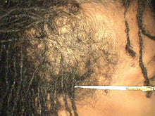 Load image into Gallery viewer, BEFORE: Embark on a journey of hair transformation with our Herbal Re-Growth Serum, carefully crafted to harness the revitalizing power of nature. Enriched with a fusion of botanical extracts, including invigorating Moringa, Nettle, Amla, Ginseng, Gingko Biloba, Lavender Essential Oil, and Revitalizing Ginseng. Our serum is a testament to the potency of herbal remedies for hair care.
