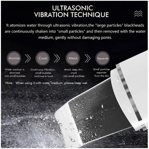 EGB 4-In-1 Derma Scrubber Ultrasonic SkinCare Enhancing Tool ...