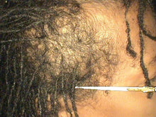 Load image into Gallery viewer, BEFORE: Embark on a journey of hair transformation with our Herbal Re-Growth Serum, carefully crafted to harness the revitalizing power of nature. Enriched with a fusion of botanical extracts, including invigorating Moringa, Nettle, Amla, Ginseng, Gingko Biloba, Lavender Essential Oil, and Revitalizing Ginseng. Our serum is a testament to the potency of herbal remedies for hair care.
